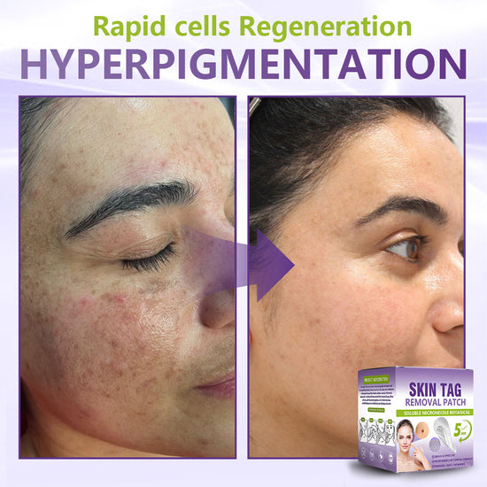 Customer result preview