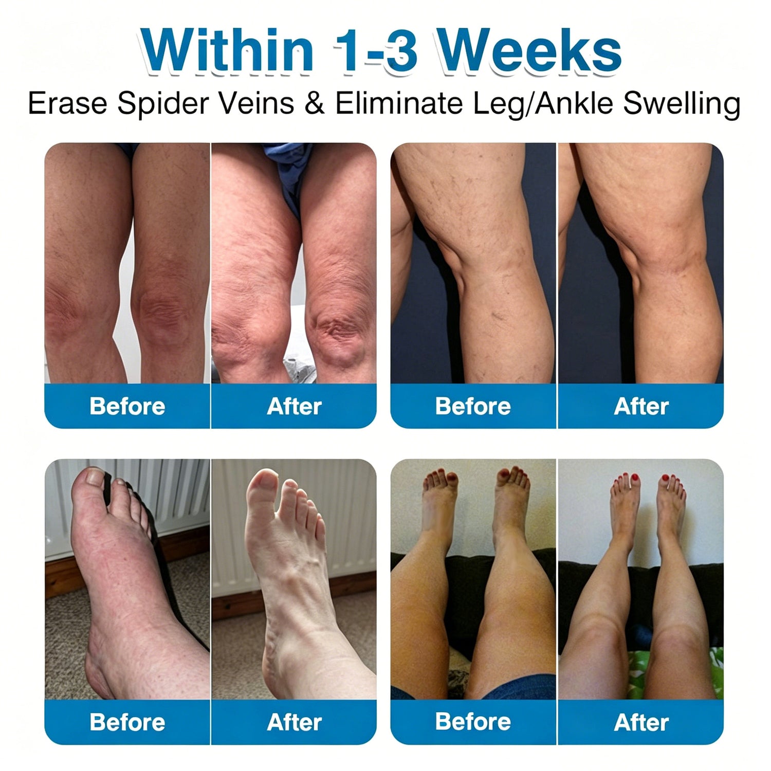 VeinRepair product image 1