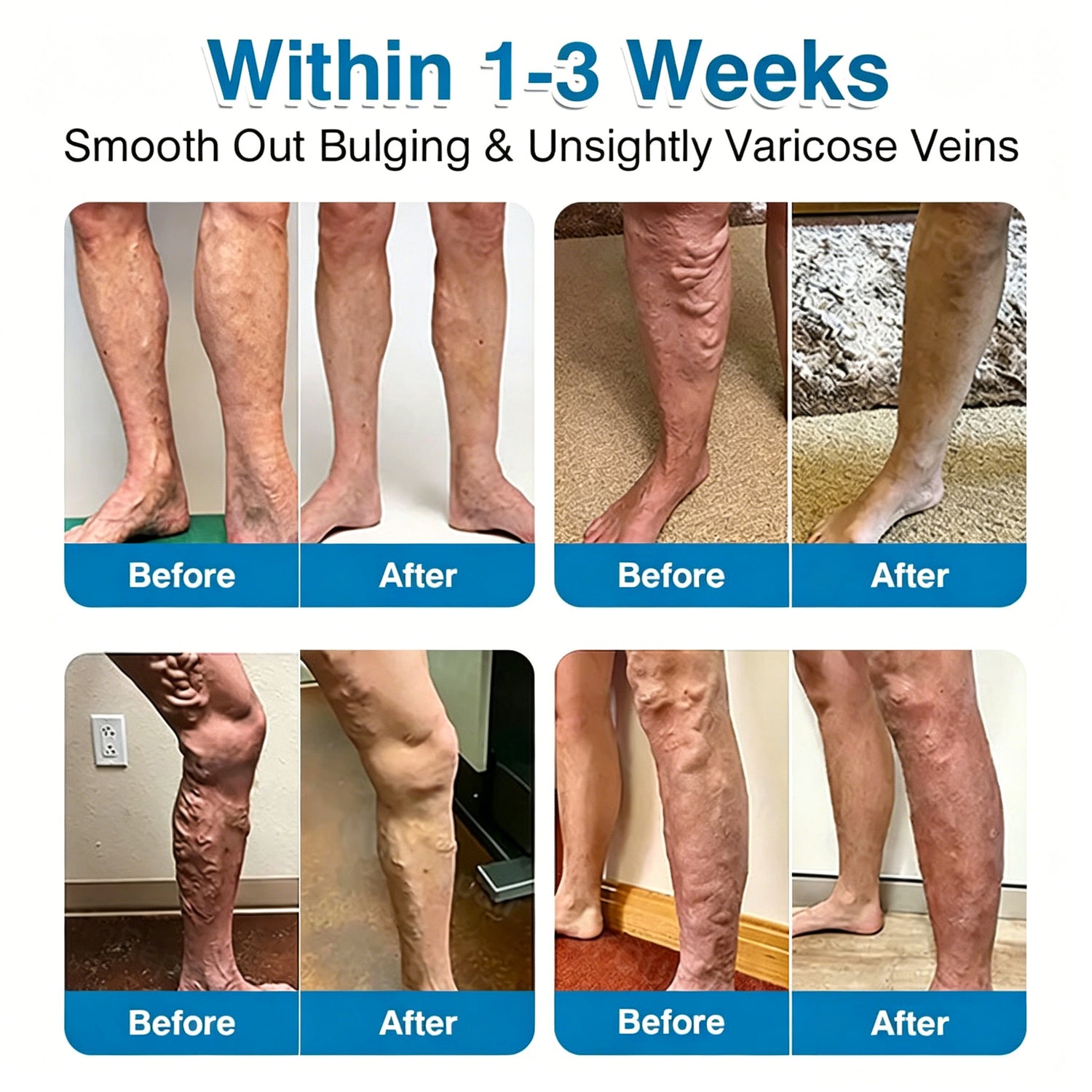 VeinRepair product image 2