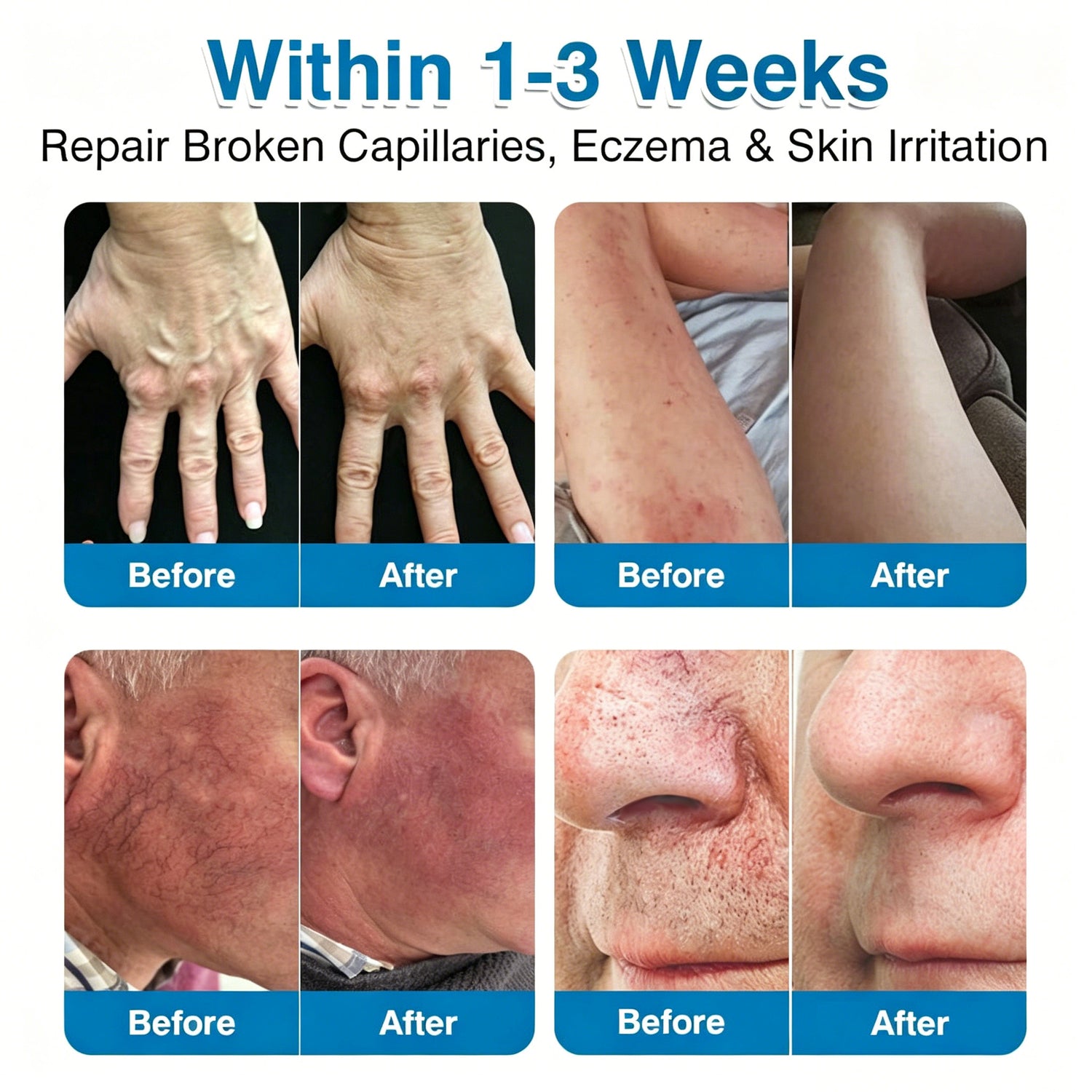 VeinRepair product image 3