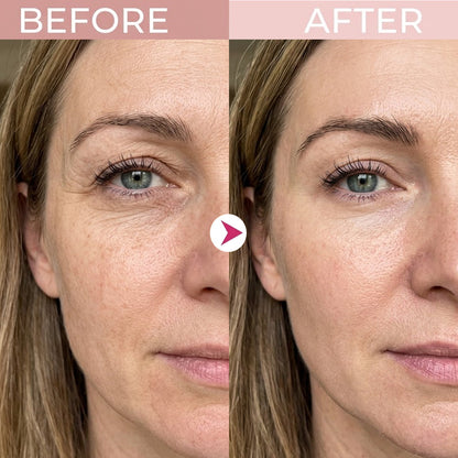 Eye Renewal Crème