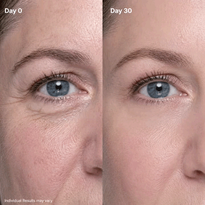 Eye Renewal Crème